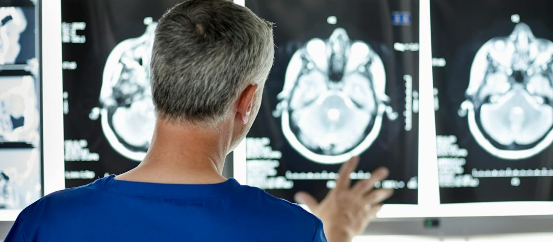 Hématome sous-dural : symptômes, causes et traitements